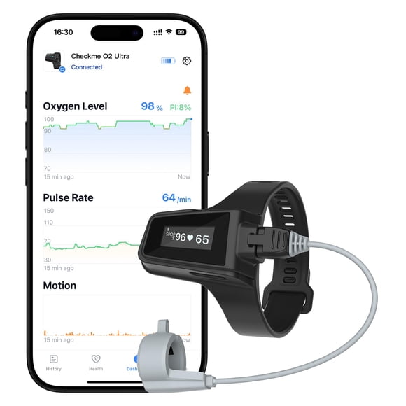 Oxímetro de Pulso para Muñeca Wellue Checkme O2 Ultra con Resistencia de 100 horas