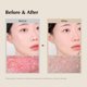 thumbnail image 5 of Espuma exfoliante de salvado de arroz Midha Face Wash, 150 ml, limpieza profunda, 5 of 8