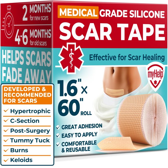 Cinta adhesiva de silicona para cicatrices MYHELP de grado médico, 4 cm x 1,5 m