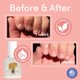 thumbnail image 5 of Tratamiento para morderse las uñas ella+mila No More Biting para niños, 5 of 8