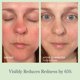 thumbnail image 4 of Spray facial Beekman 1802 59 ml Gel de leche de magnesio, 4 of 6