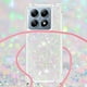 thumbnail image 5 of Funda FOXDOCK para Xiaomi 14T con Cuerda Ajustable, Brillo Líquido, Protección Antigolpes y Lente – Ideal para Regalo, 5 of 6