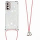 thumbnail image 3 of Funda FOXDOCK para Motorola Moto G Stylus 2022 5G con Cuerda Ajustable, Brillo Líquido, Protección Antigolpes y Lente – Ideal para Regalo, 3 of 6