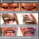 thumbnail image 5 of Kit de Dientes Instant Smile Flex Tono Natural Serie Pro, 5 of 5