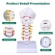 thumbnail image 2 of Modelo de Columna Cervical Ultrassist a Tamaño Natural para Enseñanza Médica, 2 of 7