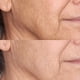 thumbnail image 3 of Crema hidratante Perricone MD de alta potencia SPF 30 60 ml, 3 of 5