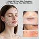 thumbnail image 3 of Máquina Facial Keicnkj 7 en 1 para Uso en Spa en Casa, 3 of 7