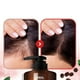 thumbnail image 2 of Shampoo Coreano Anticaída Con Cafeína Y Ácido Salicílico - (baby Powder), 2 of 3