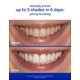thumbnail image 2 of Acelerador blanqueador Supersmile Professional 100 ml, 2 of 7