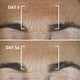 thumbnail image 5 of Tratamiento facial Filorga Global-Repair Advanced Elixir 30 ml, 5 of 9