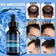 thumbnail image 3 of Aceite para el crecimiento del cabello Aemerry con 5% de minoxidil para la caída del cabello en hombres, 3 of 3