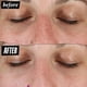thumbnail image 5 of Sérum Clearly Corrective Dark Spot 30 Ml Con Vitamina C, 5 of 9