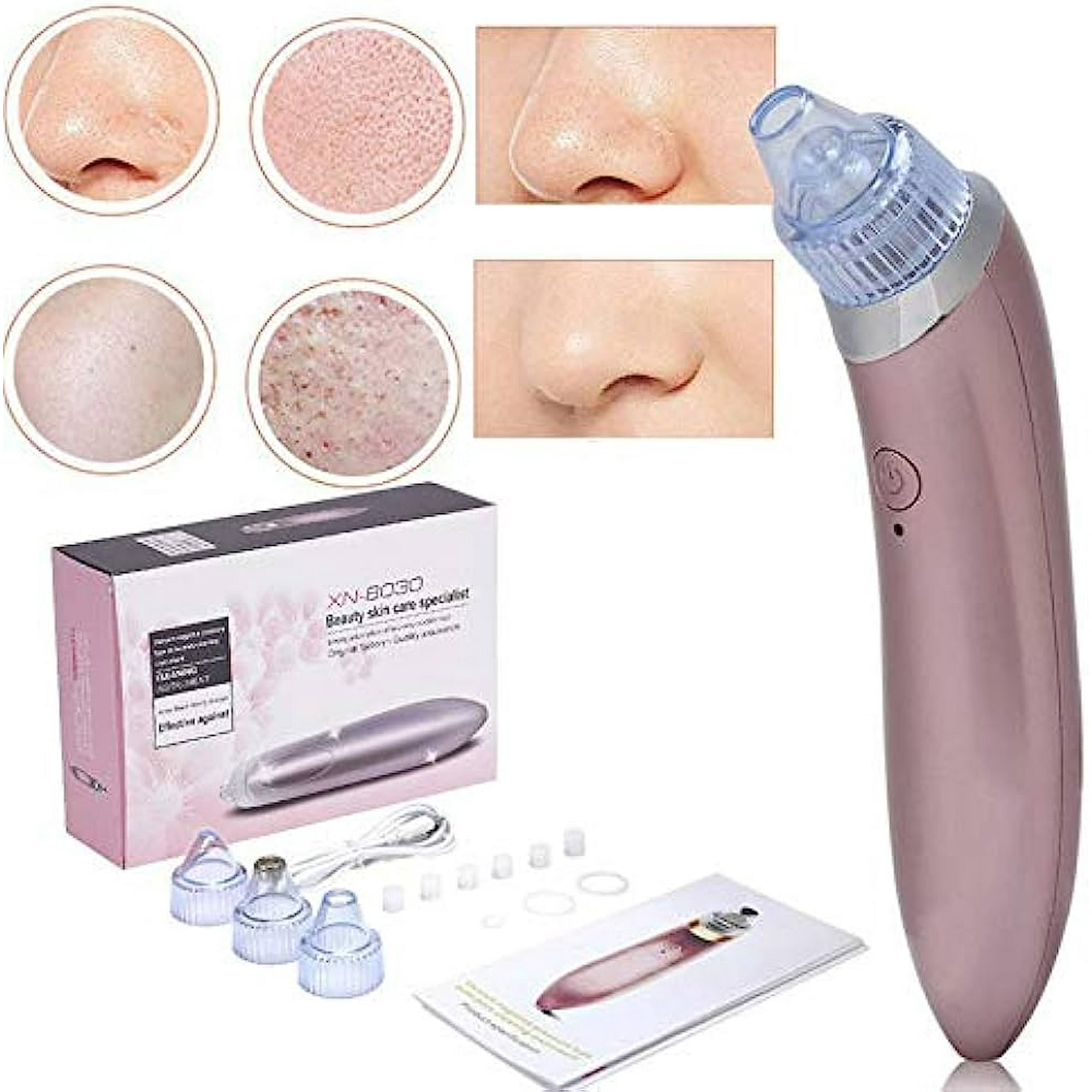 Kimale - Removedor Extractor Puntos Negros Y Espinillas Limpiador