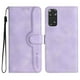 thumbnail image 1 of Funda FOXDOCK para Xiaomi Redmi Note 11 4G -Diseño elegante,Ideal para hombres y mujeres, 1 of 5