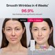 thumbnail image 4 of Mascarilla facial de terapia de luz LED Ulike ReGlow para mujer, 4 of 8