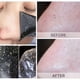 thumbnail image 2 of 15pcs Blackhead Nose Strips: Deep Cleansing Nasal Spot Facial Dot Stickers for Acne & Blackhead Removal - Dropship, 2 of 4