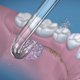 thumbnail image 3 of Repuesto de punta de hilo dental Waterpik DT-100E, 2 unidades, 3 of 3