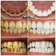 thumbnail image 2 of V34 Purple Toothpaste Whitening Teeth Enzyme Remove Plaque Stains Oral Hygiene Cleaning Dental Tools Fresh Breath Beauty Health, 2 of 3
