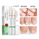 thumbnail image 2 of Health Routin Nail Care Pen Nail Fungus Pen Austria Nail Fungus Test Winner Nail Polish Cosmetic Care for Nail Fungal Infection, 2 of 3