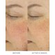 thumbnail image 3 of Suero Facial Noble Panacea 30 Dosis - Booster de Vitamina C, 3 of 9