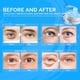 thumbnail image 2 of Parches Para Ojos Naturals Con Retinol Y Colágeno 30 Pares, 2 of 9