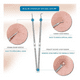 thumbnail image 3 of Kit Extractor De Comedones Espinillas 4 Piezas Doble Cabezal, 3 of 4