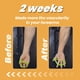 thumbnail image 4 of Ejercitador de dedos Hand Grip Strengener Pnskter (6 unidades), 4 of 6
