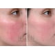 thumbnail image 2 of Crema Antirojeces Natural - Calmante e Hidratante 50 ml, 2 of 2