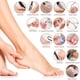thumbnail image 2 of Kit de pedicura 23 en 1, exfoliante profesional para pies, callos, cutículas y piel muerta, cortaúñas, lima y raspador., 2 of 8