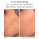 thumbnail image 2 of Base Oxygenetix Control de Grasa en Crema 15 ml, 2 of 9