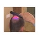 thumbnail image 5 of Cepillo Laser Fast Grow Comb Anti Caida Crecimiento Cabello, 5 of 11