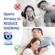 thumbnail image 5 of Protector Bucal SleepRight Snore Aid Plus + Ayuda Respiratoria Nasal, 5 of 8
