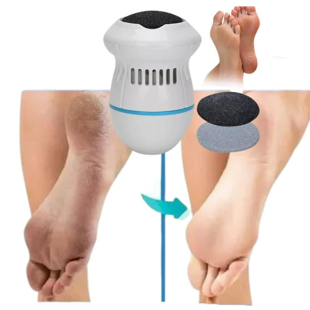 Removedor Callos Quita Durezas Pulidor Pies Electrico MX37