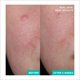 thumbnail image 3 of Crema Hidratante Gel-Crema Calmante A-CICA365 de AESTURA, 3 of 8