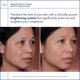 thumbnail image 4 of Set de cuidado de la piel Obagi Medical Nu-Derm System para piel normal a seca, 4 of 6