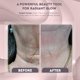 thumbnail image 4 of Beauty Device GLO24K, luz roja para rostro y cuello, paquete de 2 unidades, 4 of 7