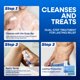 thumbnail image 3 of Kit Antifúngico Hermon para Picazón Inguinal – Spray y Jabón 60 ml, 2 barras, 3 of 9