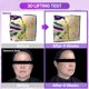 thumbnail image 3 of Serum BIOHEAL BOH Probioderm™ 3D Lifting Ampolla 30 ml, 3 of 9