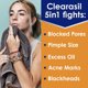 thumbnail image 3 of Limpiador Facial Clearasil Stubborn Acne Exfoliante 200ml, 3 of 3