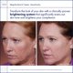 thumbnail image 5 of Set de cuidado de la piel Obagi Medical Nu-Derm System para piel normal a seca, 5 of 6