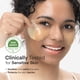 thumbnail image 4 of Parches para ojos TEREZ & HONOR con vitamina C y niacinamida, 60 unidades, 4 of 9