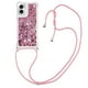 thumbnail image 1 of Funda FOXDOCK para Motorola Moto G Play 4G 2024 con Cuerda Ajustable, Brillo Líquido, Protección Antigolpes y Lente – Ideal para Regalo, 1 of 6