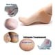 thumbnail image 3 of Par Taloneras Silicona Ortopedica Espolon Fascitis Plantar Nude Unica, 3 of 12