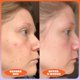 thumbnail image 5 of Serum Blume Milky Fade Spot & Scar Fade con niacinamida, 5 of 8