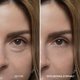 thumbnail image 4 of Retinol Eyephalt Eyebag Cream 10g, 4 of 9
