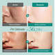 thumbnail image 5 of Set Skincare Acido Hialuronico, 5 of 5