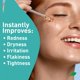 thumbnail image 2 of Sérum facial ProCure Rosacare ultrahidratante 32 ml, 2 of 3