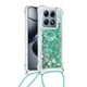 thumbnail image 2 of Funda FOXDOCK para Xiaomi 14T con Cuerda Ajustable, Brillo Líquido, Protección Antigolpes y Lente – Ideal para Regalo, 2 of 6