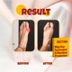 thumbnail image 4 of Férula Ortopédica Kubbar The Foot Guru Corrector de Juanetes, 4 of 8