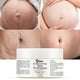 thumbnail image 2 of Crema para reducir estrías y reparar cicatrices del embarazo 7better LLC, 2 of 7